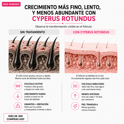 Her+ Aceite anti crecimiento del vello