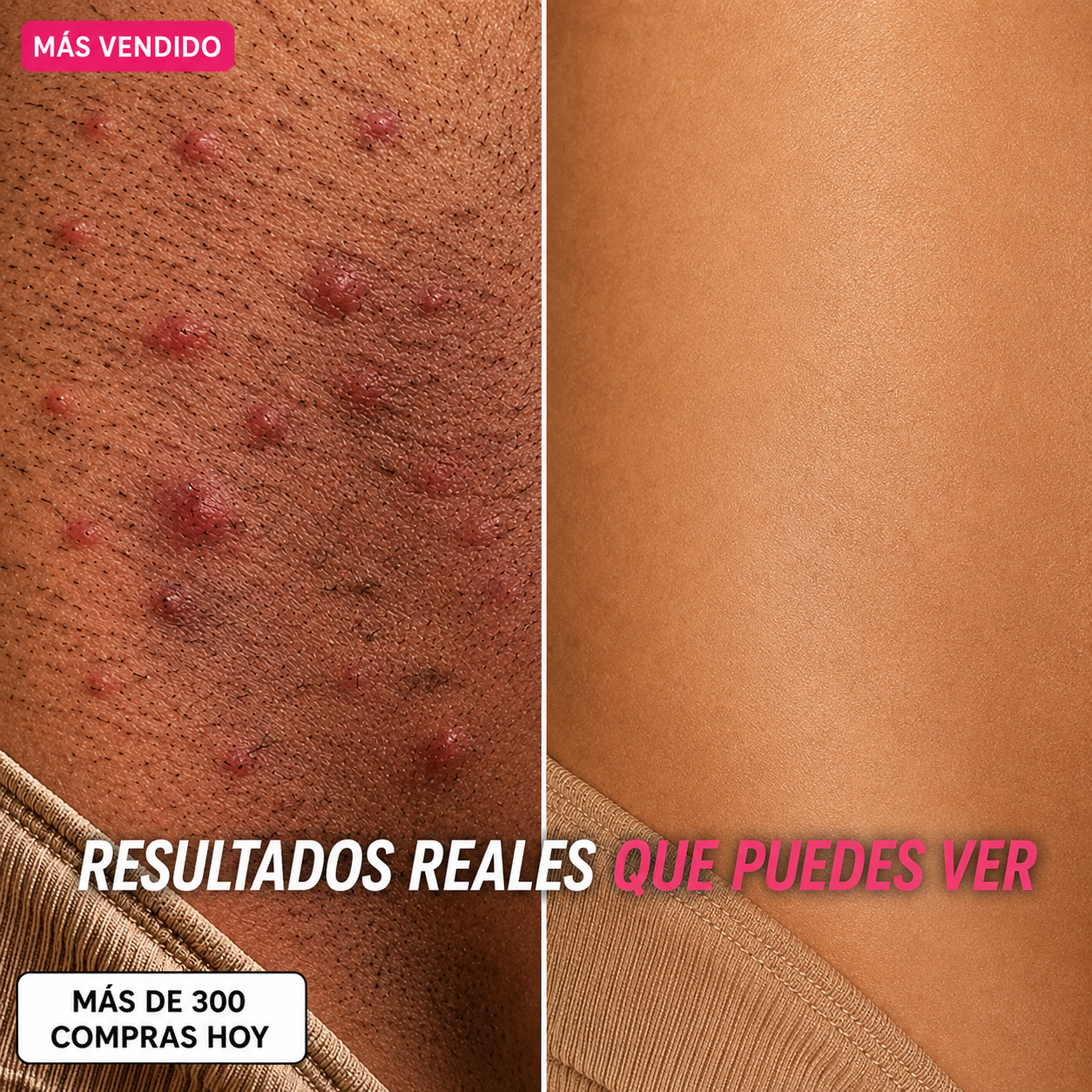 Her+ Aceite anti crecimiento del vello