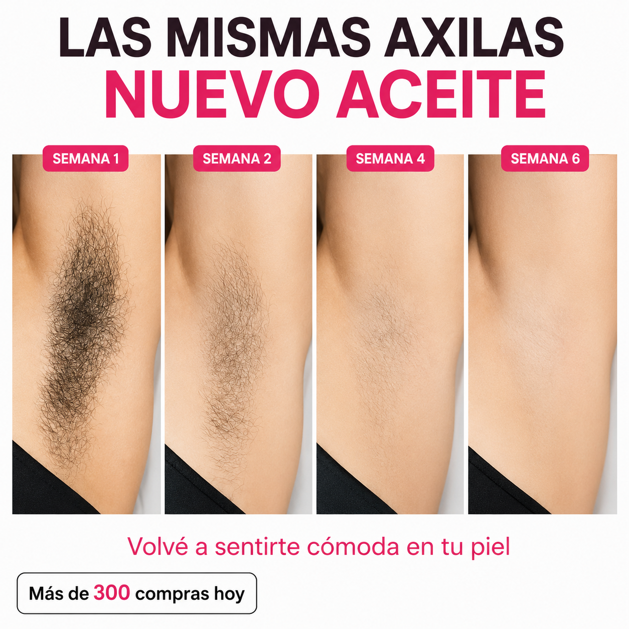 Her+ Aceite anti crecimiento del vello