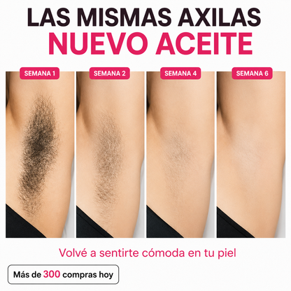 Her+ Aceite anti crecimiento del vello